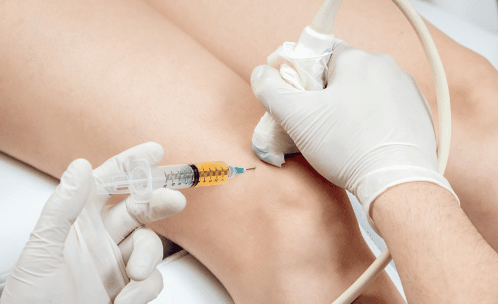 PRP Injections to Joints in Bangalore