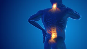 Top 10 Orthopedic Spine Treatments for Chronic Back Pain