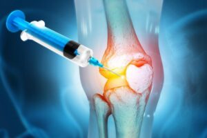 PRP Therapy for Knee Pain: Can Your Own Blood Help Your Knee Heal?